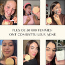 Savon Anti-Acné Chèvre-Olive